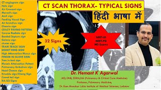 CT SCAN THORAX हिंदी भाषा में Typical Named Sign for Exams NEET SS NEETPG DrHemant K Agarwal [upl. by Revorg]