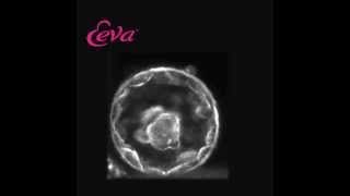 Embryo Development Day 5 Using The Eeva Test [upl. by Ydoc]