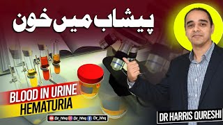 Blood In Urine  Hematuria پیشاب میں خون  DrHarris Qureshi [upl. by Onstad]