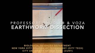 Earthworm Dissection [upl. by Bale]