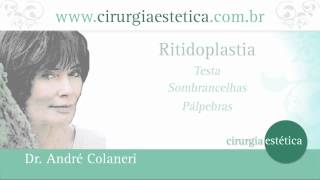 Lifting Facial  Cirurgia Plástica da Face Como é Dr Andre Colaneri explica [upl. by Sofer]