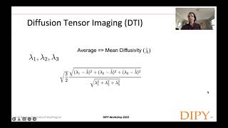 Diffusion Tensor Imaging DTI [upl. by Gad]