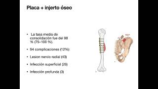 Tratamiento pseudoartrosis de Húmero [upl. by Intosh]