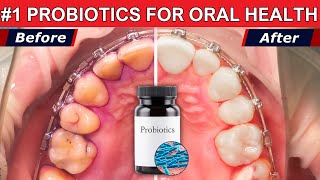 How Oral Probiotics Lactobacillus Salivarius Destroys Bad Breath and Revolutionizes Oral Health [upl. by Akkeber]