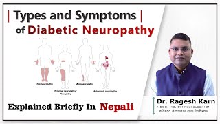 Diabetic Neuropathy Types amp Symptoms You Need to Know  Dr Ragesh Karndiabeticneuropathy [upl. by Philcox]