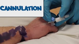 How to Perform Cannulation  OSCE Guide old version  UKMLA  CPSA [upl. by Sihonn]