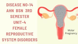 Hydatidiform MoleMolar pregnencyDisease14AHNBSN 3rdsemester Unit4female reproductive disorders [upl. by Formica]