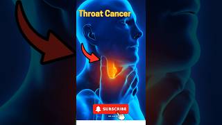 5 Key Symptoms of Throat Cancer  Recognize the Warning Signs [upl. by Eznyl]