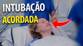 Intubação em um paciente acordado [upl. by Snah951]