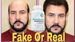 Refollium results  Regrow results  refollium review  dont buy [upl. by Concettina]