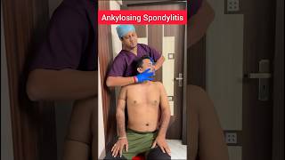 The Expert Treatment to Ankylosing spondylitis PTAnindya [upl. by Fatsug268]