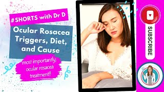 Ocular Rosacea Treatment Triggers Diet and Causes  How do you get rid of ocular rosacea shorts [upl. by Nnylimaj]