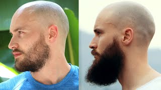 Thin Beard To Winning Beard And Back My Entire Beard Journey [upl. by Calley100]