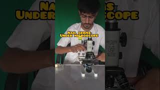 nail germs under microscope 🤮viralvedio microscope trendingshorts [upl. by Elephus764]