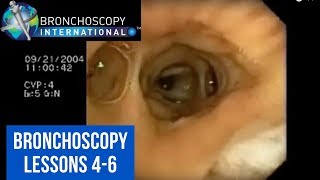 Bronchoscopy Step by Step Details Lessons 46 [upl. by Jeffry]