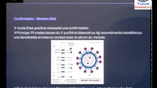 Diagnostic serologique virologique du sida biologie moléculaire [upl. by Lletnwahs]