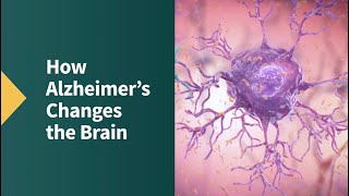 How Alzheimers Changes the Brain [upl. by Stirling]