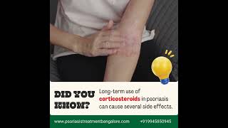 Longterm use of corticosteroids for psoriasis can lead to several side effects psoriasis [upl. by Itagaki]