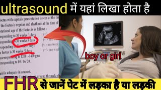 meri ultrasound se jane ladka ya ladki ultrasound report boy or girlultrasound [upl. by Moulden]