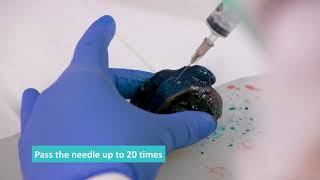 Fresh Tissue Sampling  Fine Needle Aspirate FNA Technique [upl. by Pilif649]