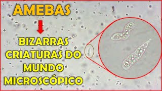 Amebas Conheça essas bizarras criaturas do mundo microscópico [upl. by Imnubulo]