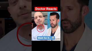 ER Doctor REACTS to Tracheostomy Hole [upl. by Rodd]