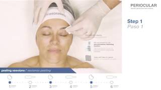 Periocular treatment by Mesoestetic [upl. by Cherri]