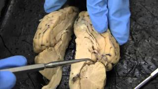 sheep brain dissection [upl. by Pelligrini]