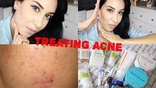 Daily Skin Care Routine ♥ Get Rid Of Acne amp Scars [upl. by Eelydnarb69]