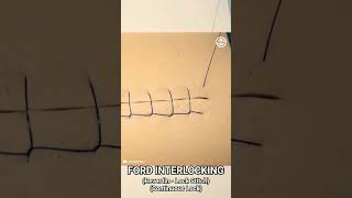 Ford Interlocking Suture Pattern Reverdin  Lock Stitch  Continuous Lock shorts memes medical [upl. by Eillam]