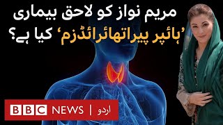 Maryam Nawaz Can Hyperparathyroidism Be Treated Only in US and Switzerland  BBC URDU [upl. by Suiravat]