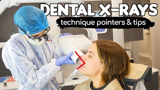 How To Take PERFECT Dental Xrays  Tips amp Tricks From A Dental Hygienist [upl. by Kester763]