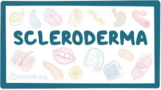 Scleroderma  an Osmosis Preview [upl. by Adaynek]