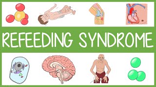 Refeeding Syndrome [upl. by Ainivad]