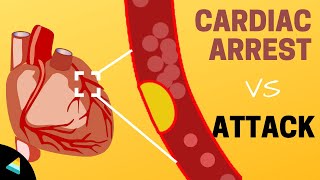 Cardiac Arrest vs Heart Attack What makes them different [upl. by Ahsienet]