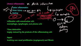 28  Chronic Inflammation  Introduction Macrophages [upl. by Swithbart129]