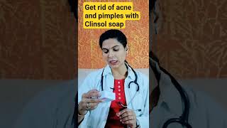 Get rid of acne and pimples with Clinsol soap shorts [upl. by Damales]