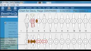 Customize Your Charting Screen  DentiMax Dental Software Tip [upl. by Tamara]