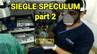 Siegle speculum part 2 [upl. by Corrianne]