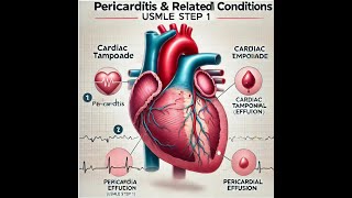 PericarditisCardiac tamponadePericardial effusionUSMLE STEP 1 Review [upl. by Haerdna339]