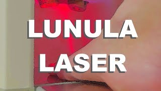 Lunula Laser  Fungal Infection Removal With Lasers [upl. by Reifnnej]