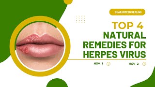 4 Proven Natural Remedies for Herpes Heal Yourself Naturally [upl. by Bendicty]