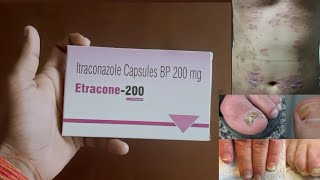 Itraconazole Capsule💊 Bp 200100mgUse Dose Side Effects and Price in Hindi  Anti Fungal Drug [upl. by Aridatha]