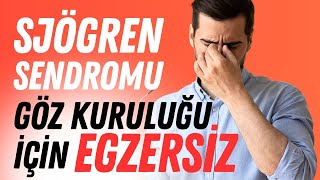 Sjogren Sendromu Tanısı Koyuldu Göz Kuruluğu Geçmiyor Egzersiz [upl. by Lenore]