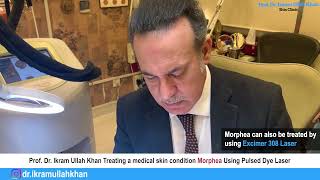 Morphea No More Pulsed Dye Laser Therapy Unveiled for Treatment morpheatreatment lasermachine [upl. by Halas]