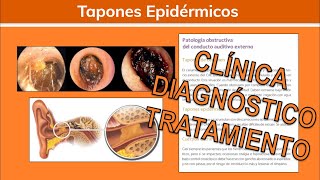 ⚕️🩺 Otocerosis TAPÓN DE CERÚMEN y Cuerpos Extraños  Otorrinolaringología [upl. by Atsirhcal]