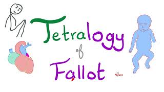 Tetralogy of Fallot TOF  Cyanotic Congenital Heart Disease CHD  Cardiology 🫀 [upl. by Eidas45]