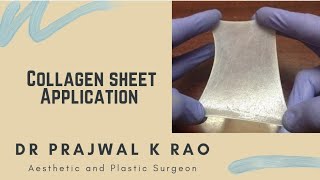 Collagen Sheet Dressing  Wound Management  Plastic Surgery [upl. by Ygief]