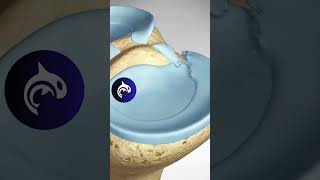 See how a Meniscus Root Repair of the Knee works  3D animation meniscus [upl. by Egon]