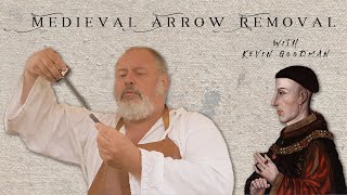 Removing the Arrow from Henry Vs Face [upl. by Ardath]